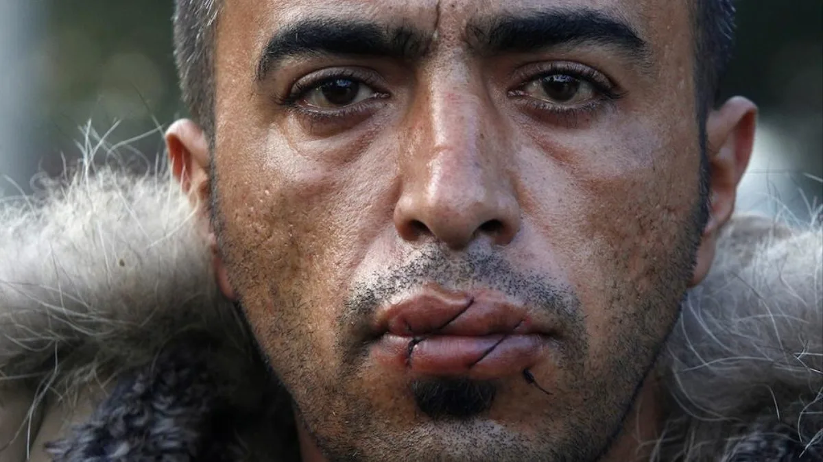Retratos dos Manifestantes Iranianos que Costuraram suas Bocas na Fronteira da Grécia com a Macedônia